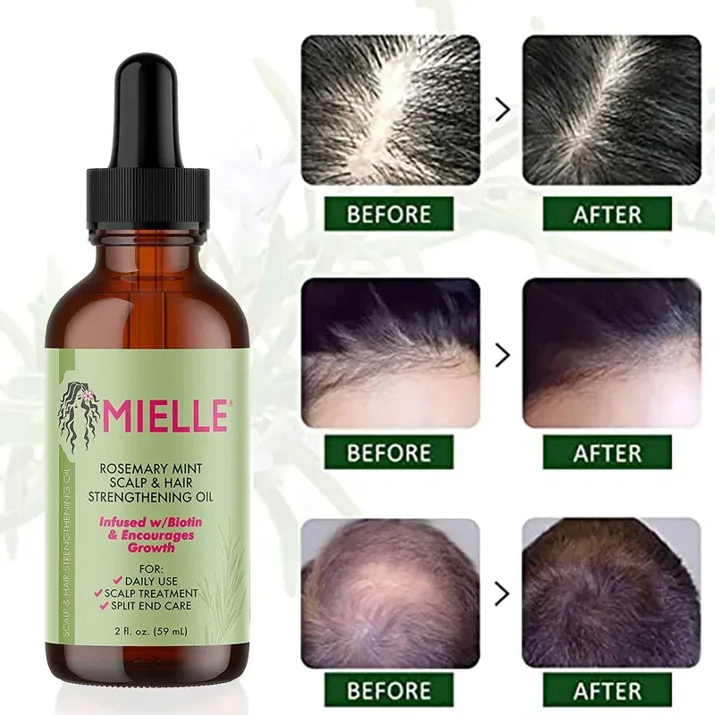 MIELLE Rosemary Mint Scalp & Hair Strengthening Oil for Hair Growth